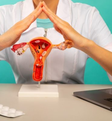 Ovarian Endometriosis (1)