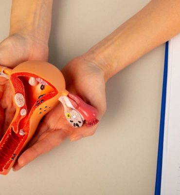 Umbilical Endometriosis (1) (1)